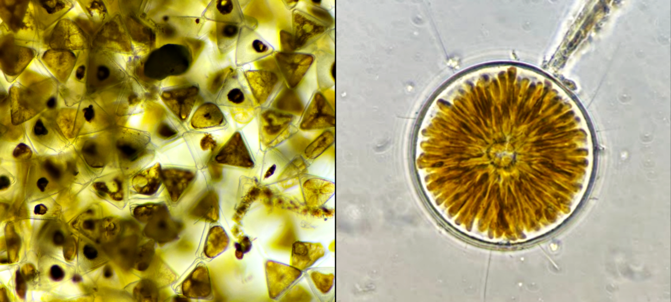 Diatoms under the microscope