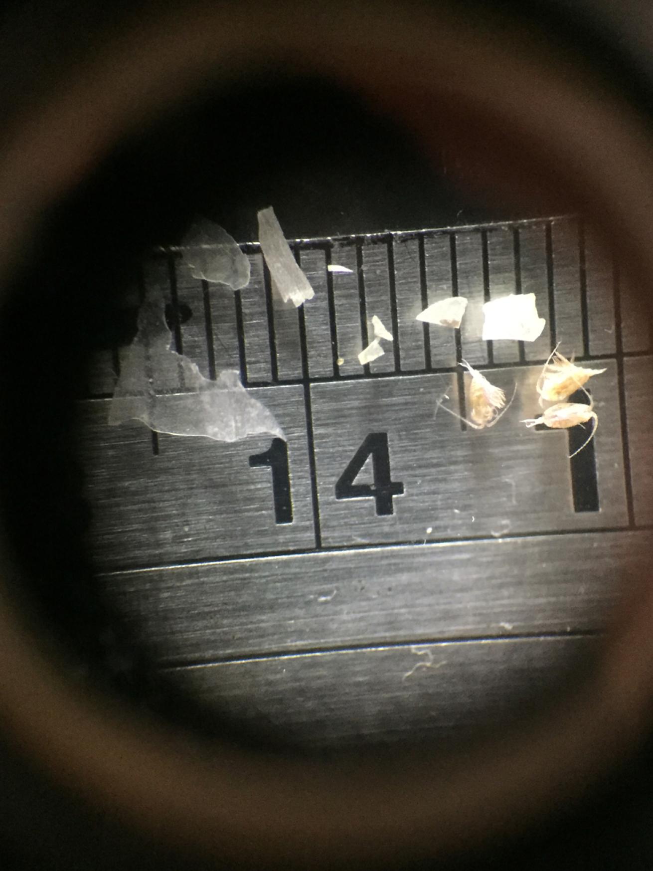 Microplastics under Microscope