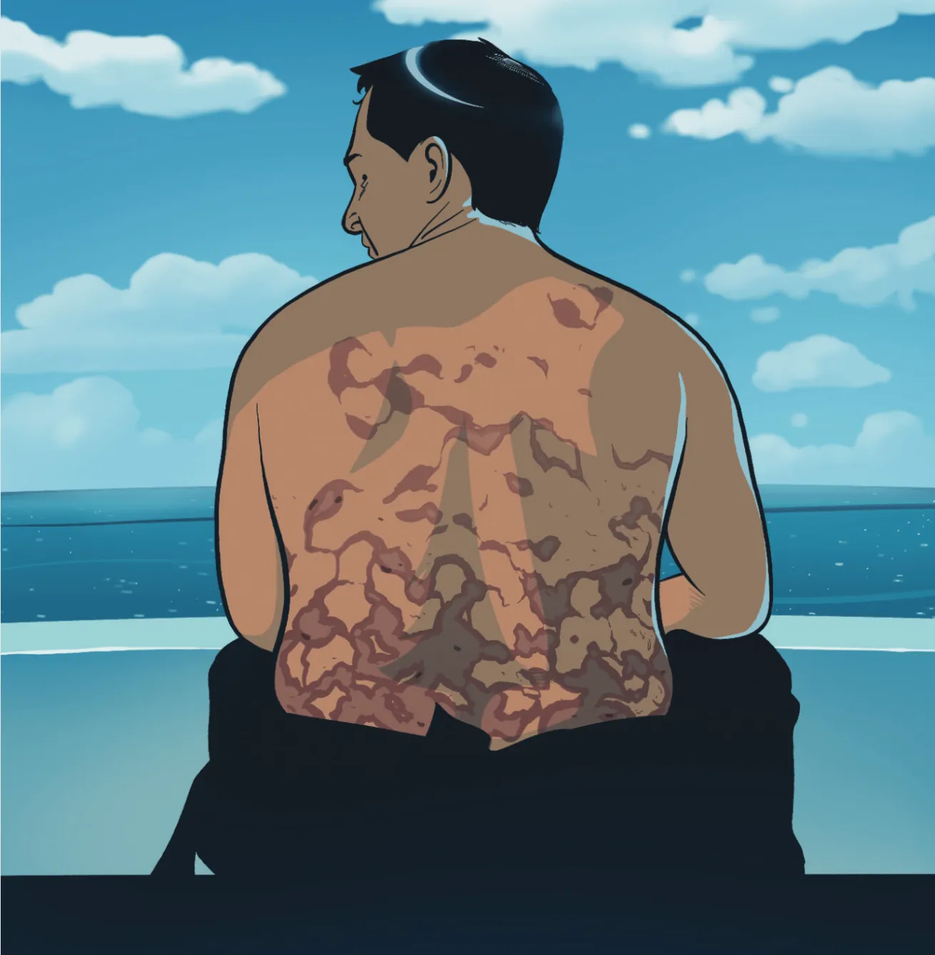 A Rash of Problems | Lessons for Life | Scuba Diving