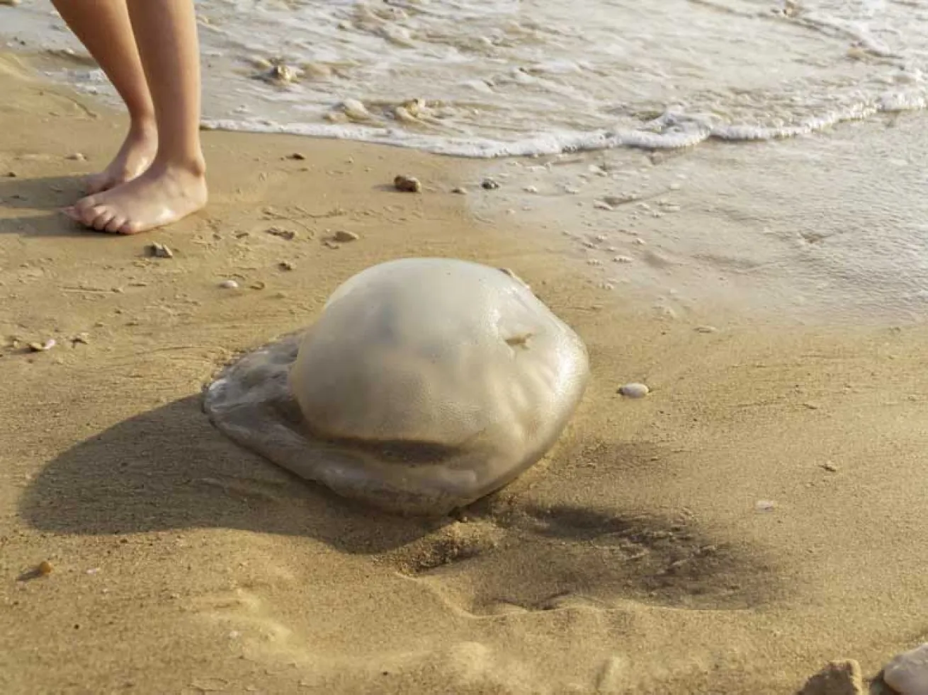 jellyfish stings