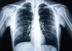 doc_.jpg.webp