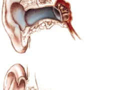 TR_end_ear_pain.gif.webp
