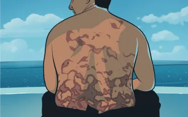 rash-illustration-stephen-p-hughes.png.webp