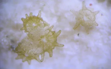 starcoralpolyps_credit_southeastfisheriessciencecenter.jpg.webp